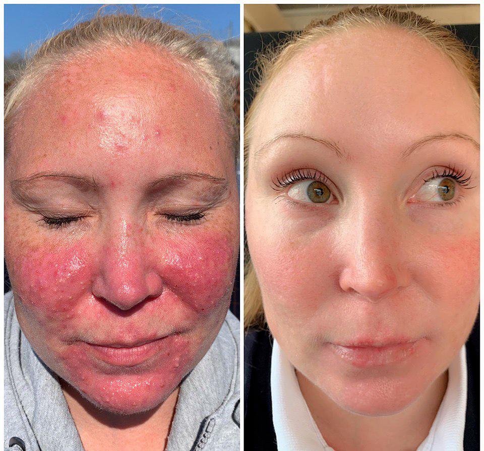 Bee Venom Skin Repair Cream