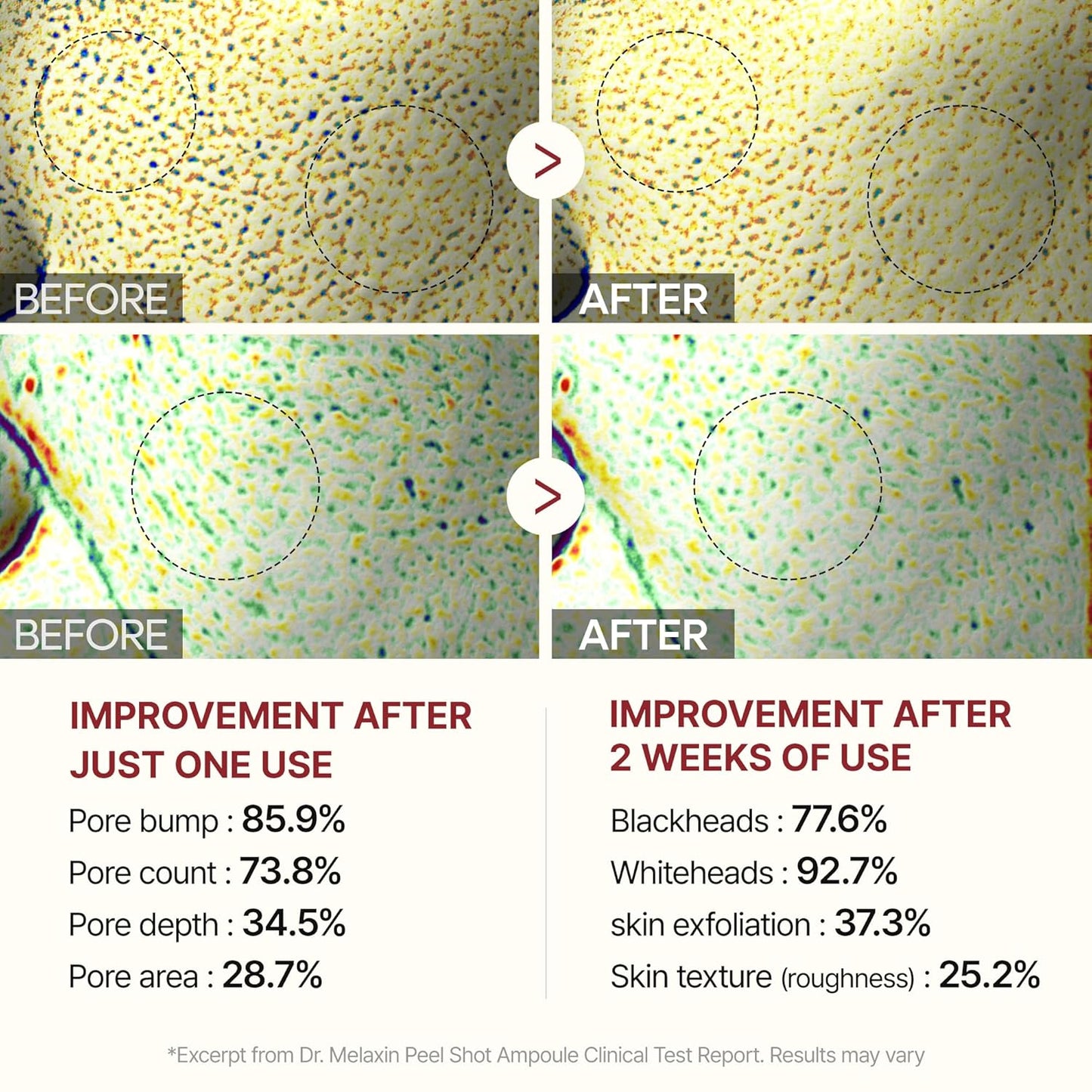 GlowRice™ Radiance Peeling Ampoule Duo