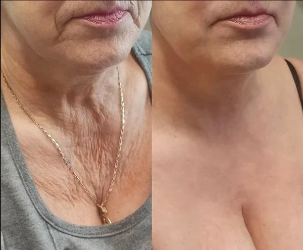 Bee Venom Skin Repair Cream