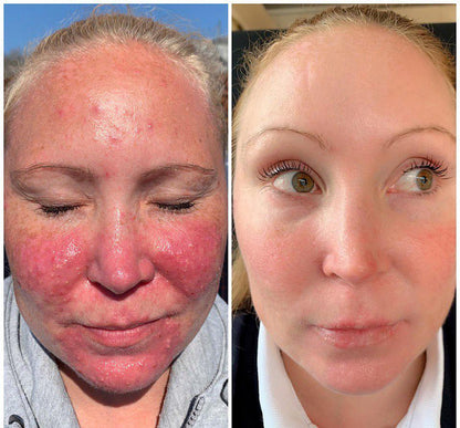 Bee Venom Skin Repair Cream