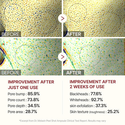 GlowRice™ Radiance Peeling Ampoule Duo