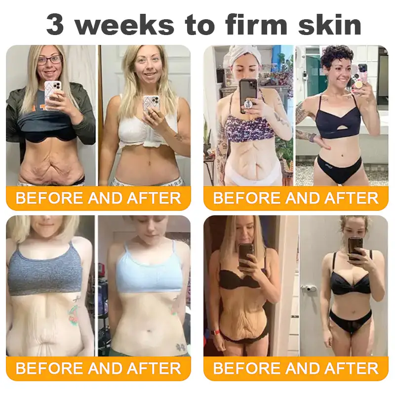 Bee Venom Skin Repair Cream