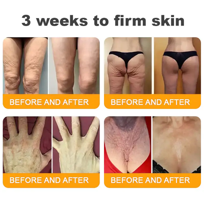 Bee Venom Skin Repair Cream