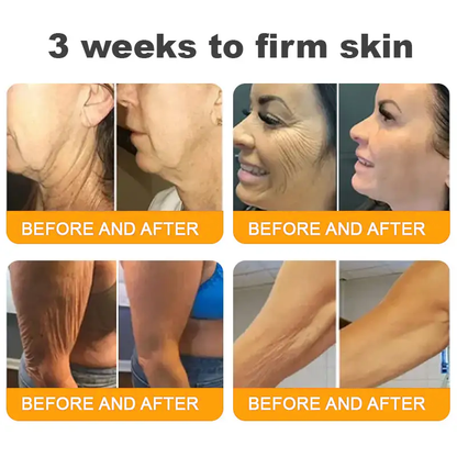 Bee Venom Skin Repair Cream