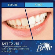 GearWithLove™ MagicBrite LED Teeth Whitening Kit